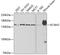 Potassium Voltage-Gated Channel Subfamily H Member 2 antibody, 18-888, ProSci, Western Blot image 