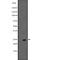 Interferon Alpha And Beta Receptor Subunit 2 antibody, abx219515, Abbexa, Western Blot image 