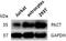 Protein Activator Of Interferon Induced Protein Kinase EIF2AK2 antibody, GTX54644, GeneTex, Western Blot image 