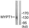 Protein Phosphatase 1 Regulatory Subunit 12A antibody, LS-C117672, Lifespan Biosciences, Western Blot image 