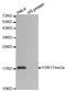 Histone H3 antibody, STJ23965, St John