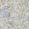 Dyskerin Pseudouridine Synthase 1 antibody, 18-354, ProSci, Immunohistochemistry paraffin image 