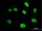 Minichromosome Maintenance Complex Component 4 antibody, H00004173-B01P, Novus Biologicals, Immunocytochemistry image 
