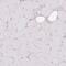 Protein Kinase C Substrate 80K-H antibody, PA5-60419, Invitrogen Antibodies, Immunohistochemistry frozen image 