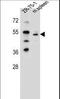 T-box transcription factor TBX6 antibody, LS-C161756, Lifespan Biosciences, Western Blot image 