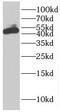 Eukaryotic Translation Initiation Factor 5 antibody, FNab02727, FineTest, Western Blot image 