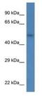 Syndecan 3 antibody, NBP1-74216, Novus Biologicals, Western Blot image 