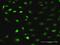 Ribosome Biogenesis Regulator 1 Homolog antibody, H00023212-D01P, Novus Biologicals, Immunofluorescence image 