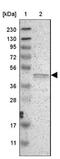 Protein Kinase X-Linked antibody, NBP1-87267, Novus Biologicals, Western Blot image 