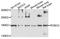 Roundabout Guidance Receptor 2 antibody, STJ112110, St John