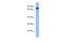 DEAH-Box Helicase 40 antibody, A14749, Boster Biological Technology, Western Blot image 