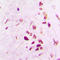 p53 antibody, LS-C358383, Lifespan Biosciences, Immunohistochemistry frozen image 