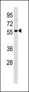 3-Oxoacid CoA-Transferase 2 antibody, PA5-49312, Invitrogen Antibodies, Western Blot image 