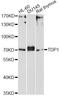 Tyrosyl-DNA phosphodiesterase 1 antibody, A4849, ABclonal Technology, Western Blot image 