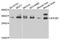 Eukaryotic Translation Initiation Factor 2B Subunit Alpha antibody, STJ110201, St John
