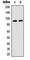 Ribosomal Protein S6 Kinase A5 antibody, abx121917, Abbexa, Western Blot image 