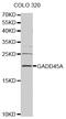 Growth Arrest And DNA Damage Inducible Alpha antibody, MBS125069, MyBioSource, Western Blot image 