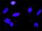 Ribosomal Protein S6 Kinase A2 antibody, H00006196-M01, Novus Biologicals, Proximity Ligation Assay image 