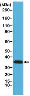 Calponin 1 antibody, NBP2-61504, Novus Biologicals, Western Blot image 