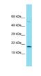 Uncharacterized protein C20orf197 antibody, orb326896, Biorbyt, Western Blot image 