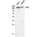 Telomerase Reverse Transcriptase antibody, A00012-2, Boster Biological Technology, Western Blot image 