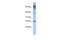 LDOC1 Regulator Of NFKB Signaling antibody, PA5-41537, Invitrogen Antibodies, Western Blot image 