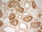 Tissue Factor Pathway Inhibitor antibody, LS-C339822, Lifespan Biosciences, Immunohistochemistry paraffin image 