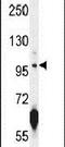 Carnosine Synthase 1 antibody, PA5-24080, Invitrogen Antibodies, Western Blot image 