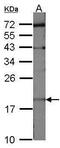 Ubiquitin Conjugating Enzyme E2 C antibody, PA5-27223, Invitrogen Antibodies, Western Blot image 