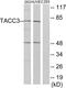 Transforming Acidic Coiled-Coil Containing Protein 3 antibody, PA5-39558, Invitrogen Antibodies, Western Blot image 