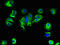 Solute Carrier Family 25 Member 14 antibody, LS-C396485, Lifespan Biosciences, Immunofluorescence image 