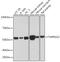 Transmembrane Serine Protease 2 antibody, 24-034, ProSci, Western Blot image 