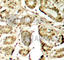 Myocyte Enhancer Factor 2A antibody, AP0405, ABclonal Technology, Immunohistochemistry paraffin image 