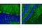 Protein Phosphatase 1 Regulatory Inhibitor Subunit 1B antibody, 11893S, Cell Signaling Technology, Immunofluorescence image 