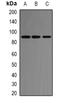Angiotensin I Converting Enzyme 2 antibody, LS-C413153, Lifespan Biosciences, Western Blot image 