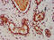 ADP-Ribosyltransferase 5 antibody, LS-C399450, Lifespan Biosciences, Immunohistochemistry paraffin image 