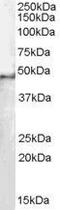 Splicing Factor 3b Subunit 4 antibody, GTX11803, GeneTex, Western Blot image 