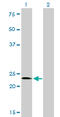 Sal-like protein 2 antibody, LS-C133422, Lifespan Biosciences, Western Blot image 