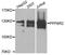 Protein Phosphatase 6 Regulatory Subunit 2 antibody, A8359, ABclonal Technology, Western Blot image 