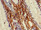 Matrix Metallopeptidase 13 antibody, LS-C318143, Lifespan Biosciences, Immunohistochemistry paraffin image 