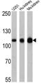 ATPase Na+/K+ Transporting Subunit Alpha 1 antibody, GTX22871, GeneTex, Western Blot image 