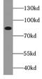 Transient Receptor Potential Cation Channel Subfamily C Member 1 antibody, FNab09014, FineTest, Western Blot image 
