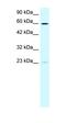 SPT3 Homolog, SAGA And STAGA Complex Component antibody, orb329562, Biorbyt, Western Blot image 