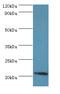 ADP Ribosylation Factor 3 antibody, MBS1493727, MyBioSource, Western Blot image 