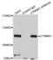 Catenin Alpha 1 antibody, LS-C334181, Lifespan Biosciences, Immunoprecipitation image 