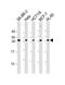 N(Alpha)-Acetyltransferase 10, NatA Catalytic Subunit antibody, M02890, Boster Biological Technology, Western Blot image 