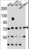 SEC14 Like Lipid Binding 5 antibody, LS-C168928, Lifespan Biosciences, Western Blot image 