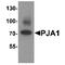 Praja Ring Finger Ubiquitin Ligase 1 antibody, TA349130, Origene, Western Blot image 