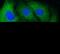 Microtubule Associated Protein 1B antibody, FNab04974, FineTest, Immunofluorescence image 