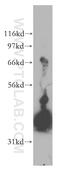 G Protein Subunit Alpha I1 antibody, 12617-1-AP, Proteintech Group, Western Blot image 